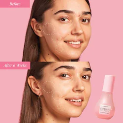 Glow Recipe Glow & Go Summer Essentials Kit with Niacinamide