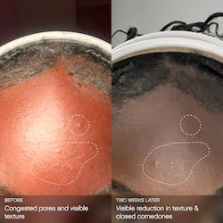 Topicals Clearly Clarifying & Calming Mist For Acne-Prone Skin