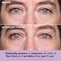 Peter Thomas Instant FIRMx® Collagen Tightening Eye Patches for Firming Under-Eye Bags & Wrinkles