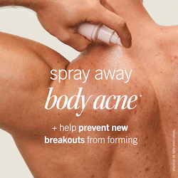 First Aid Beauty Body Acne Clearing Mist  - 2% Salicylic Acid Acne Treatment
