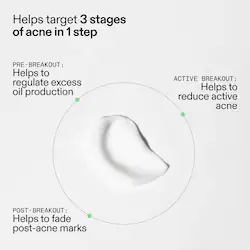 The INKEY List 360 Acne Clearing Serum with Dioic & Salicylic Acid