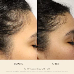 Vegamour GRO+ Advanced Growth & Density Supplements for Hair Thinning and Loss