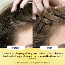 BondiBoost HG Lock Drops Daily Hair Serum With Rosemary for Thinning Hair