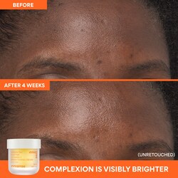 innisfree Vitamin C Brightening Refillable Gel Cream Moisturizer for Dark Spots​