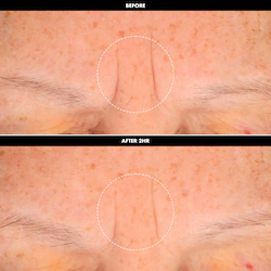 SEPHORA COLLECTION Face Tape