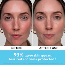 Peter Thomas Roth Water Drench® Hyaluronic Balm Barrier Cream Moisturizer for Redness and Dry Skin