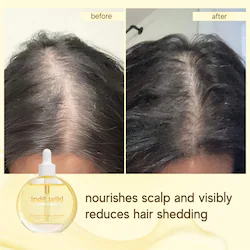 indē wild Mini Champi Hair & Scalp Pre-Wash Oil for Thinning Hair