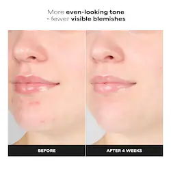 Paula's Choice Skin Perfecting 1% BHA Gentle Exfoliating Gel Toner for Sensitive Skin